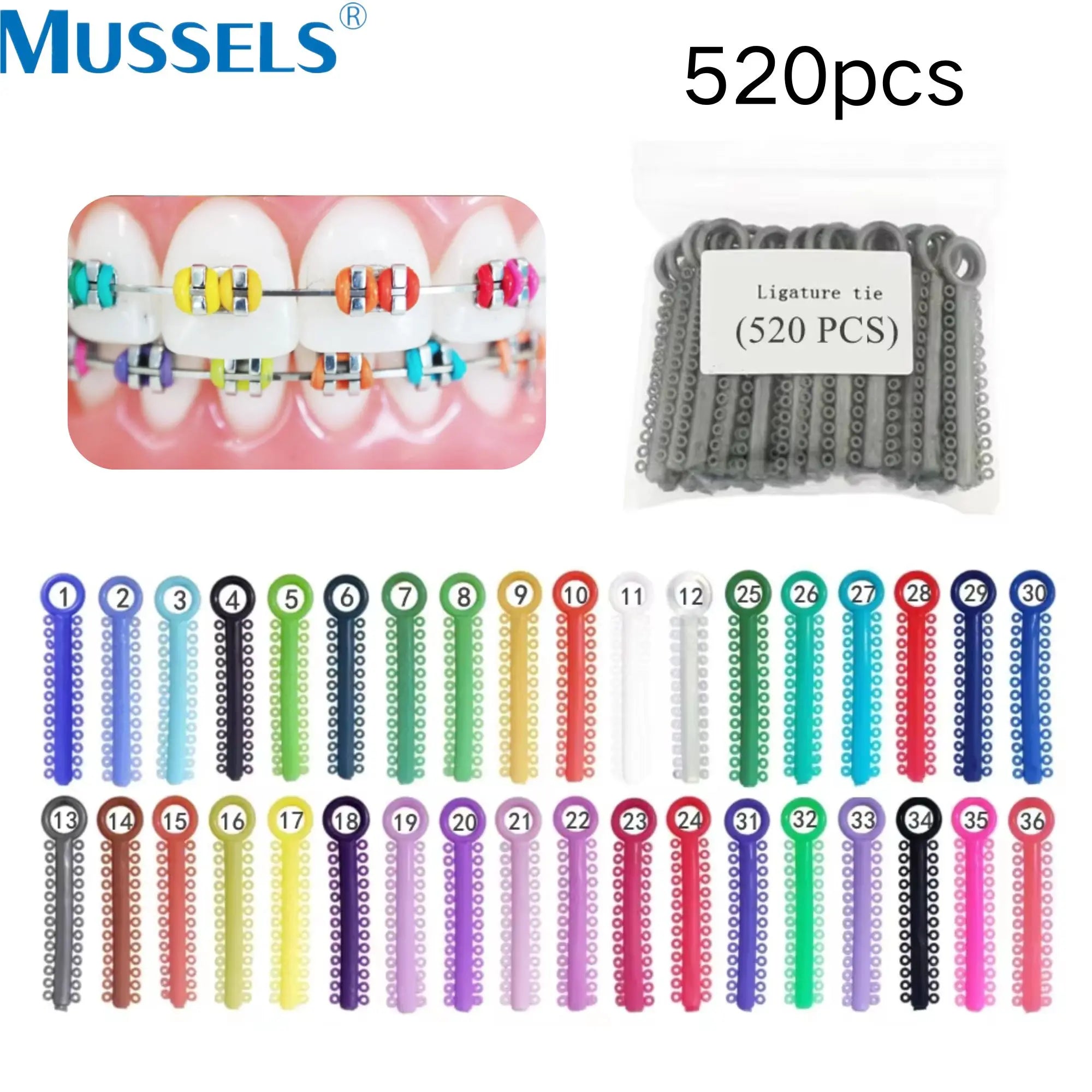 Orthodontic Elastic Ligature Ties for Dental Braces - 1