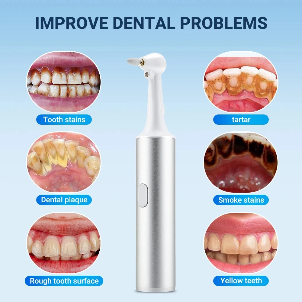 Electric Dental Tartar Remover and Teeth Whitening Polisher - 2