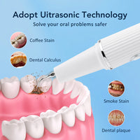 Visual Ultrasonic Tooth Plaque and Tartar Remover
