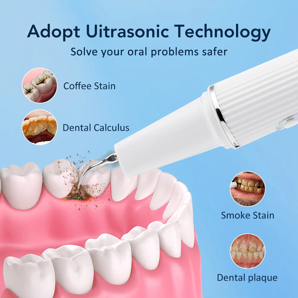 Visual Ultrasonic Tooth Plaque and Tartar Remover - 12