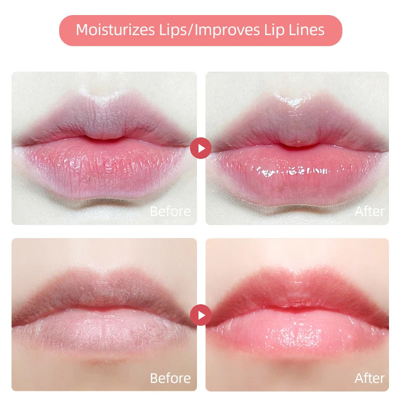 Nourishing Honey & Cherry Lip Oil for Dry, Cracked Lips - 6