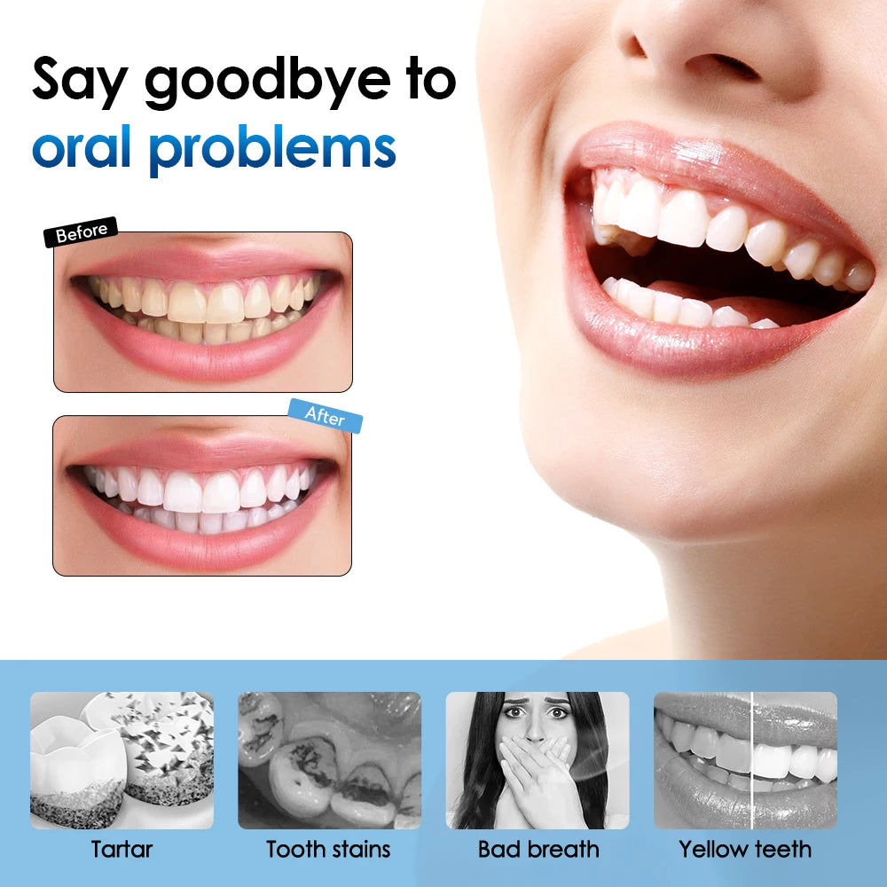 Electric Sonic Dental Calculus Remover & Teeth Whitening Kit - 26