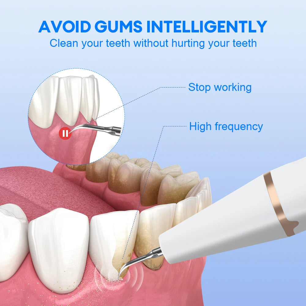 Ultrasonic Teeth Cleaner and Whitening Kit - 5