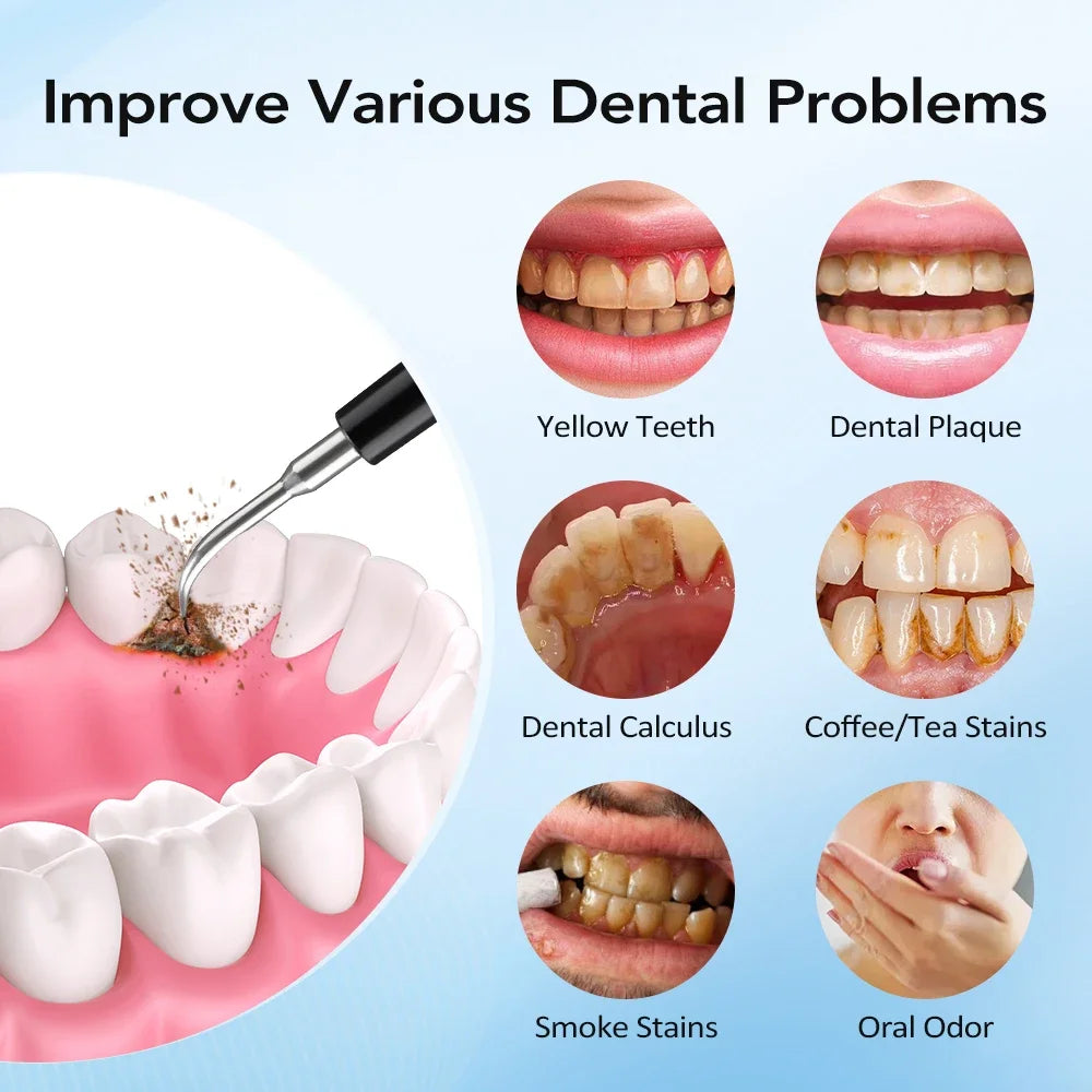 Sonic Electric Teeth Tartar and Plaque Remover - 5
