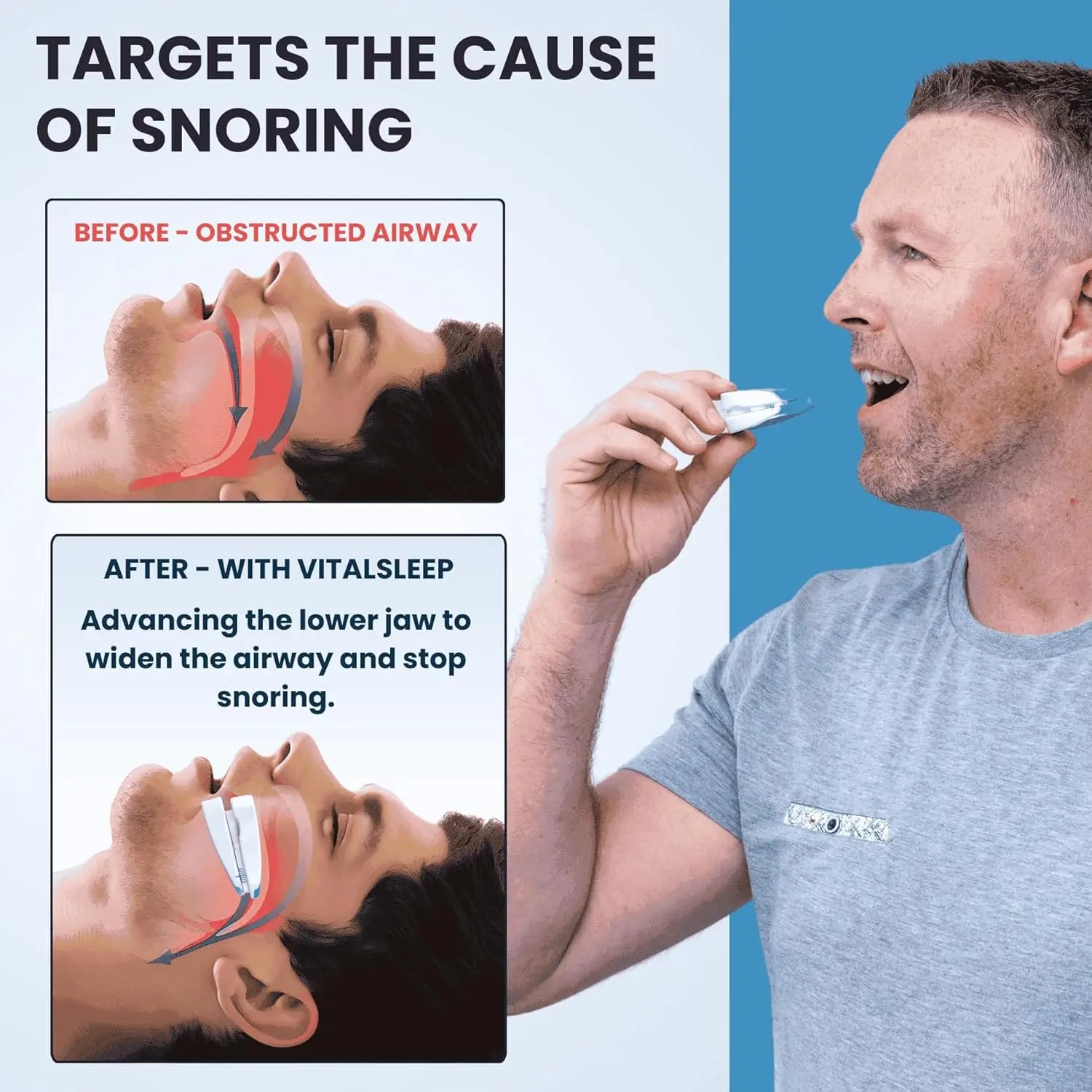 Adjustable Anti-Snoring Sleep Mouthpiece - 9