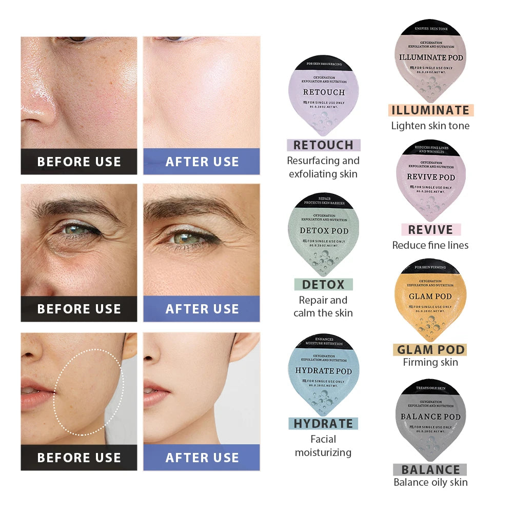 CO2 Oxygen Facial Treatment Capsules for Skin Rejuvenation - 12