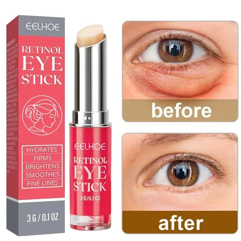 Retinol Anti-Aging Eye Balm for Dark Circles and Puffiness