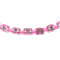 Temporary Fashion Dental Braces for Aesthetic Smile Decoration
