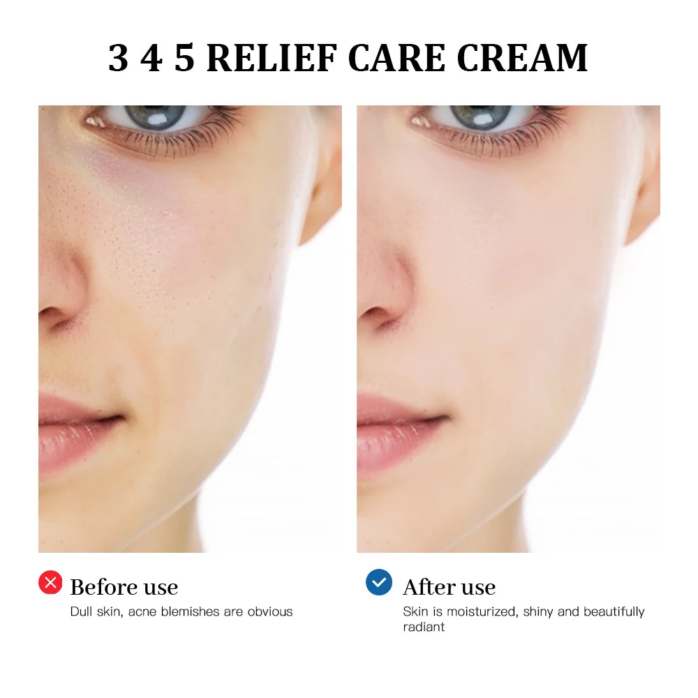 345 Multi-Ingredient Relief Cream for Blemishes and Sensitive Skin - 3