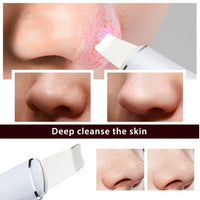 Ultrasonic Facial Skin Scrubber for Deep Pore Cleansing