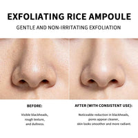 Exfoliating Rice Essence for Radiant and Smooth Skin
