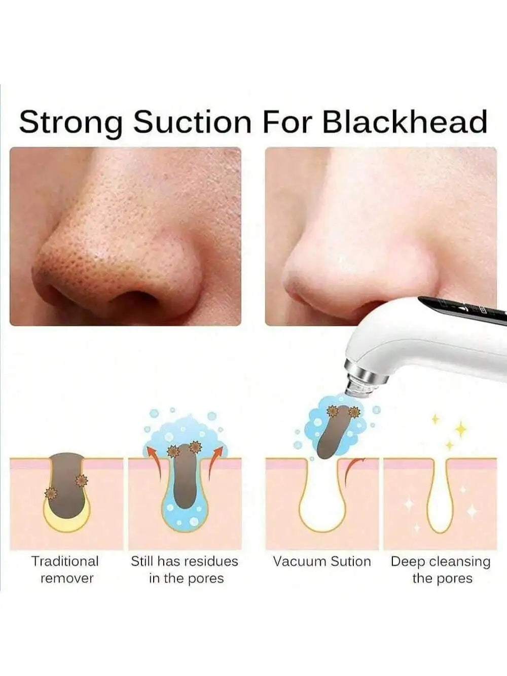 Electric Pore Vacuum and Water Circulation Blackhead Remover - 2