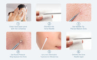 5-Piece Stainless Steel Blackhead and Acne Removal Kit