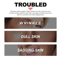 Retinol Anti-Aging Eye Balm for Dark Circles and Puffiness