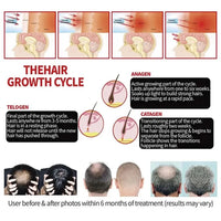 LED Red Light Therapy Cap for Hair Regrowth and Scalp Health