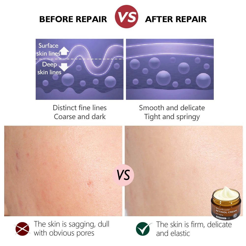 Anti-Aging Retinol Face Cream for Firming and Wrinkle Reduction - 15