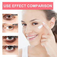 Retinol Anti-Aging Eye Balm for Dark Circles and Puffiness