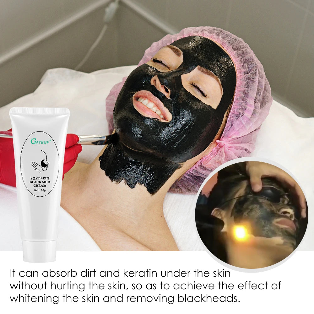 Carbon Laser Facial Resurfacing Gel for Deep Pore Cleansing - 4