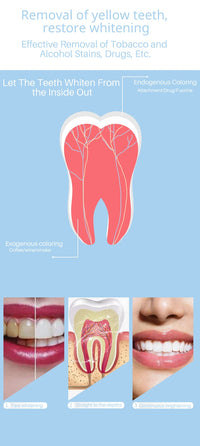 Professional LED Teeth Whitening System