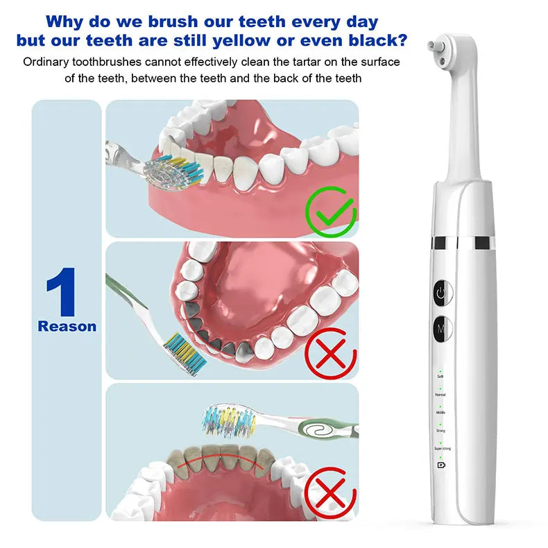 Electric Tooth Polisher for Home Teeth Whitening and Stain Removal - 7