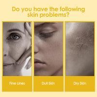 Kojic Acid Turmeric Overnight Peel-Off Mask for Radiant Skin