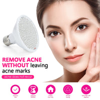 LED Photon Therapy Lamp for Acne and Skin Rejuvenation