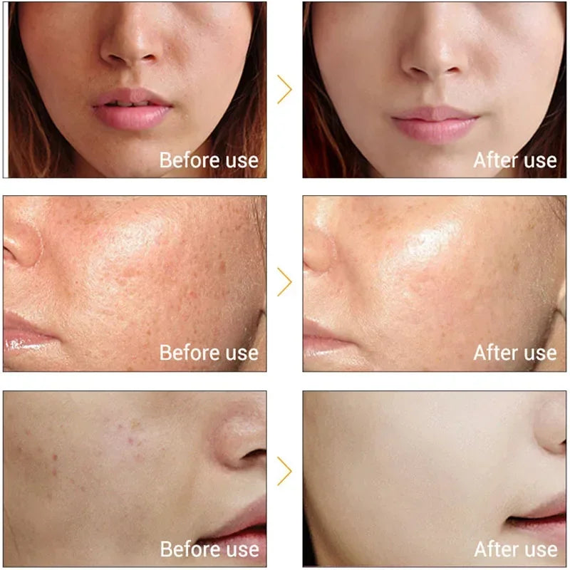 Ultrasonic Ionic Facial Skin Tightening and Cleaning Device - 5