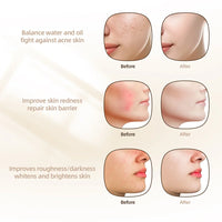 7-Color LED Photon Therapy Silicone Facial Mask