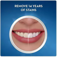 Professional Teeth Whitening Strips for At-Home Use
