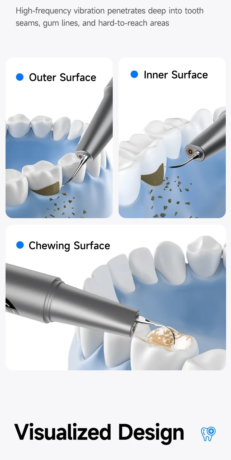 Visible Ultrasonic Teeth Whitening & Plaque Remover - 14