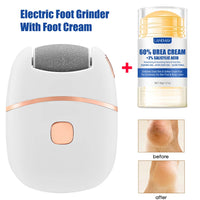 Electric Callus Remover & Repair Cream Kit for Smooth Heels