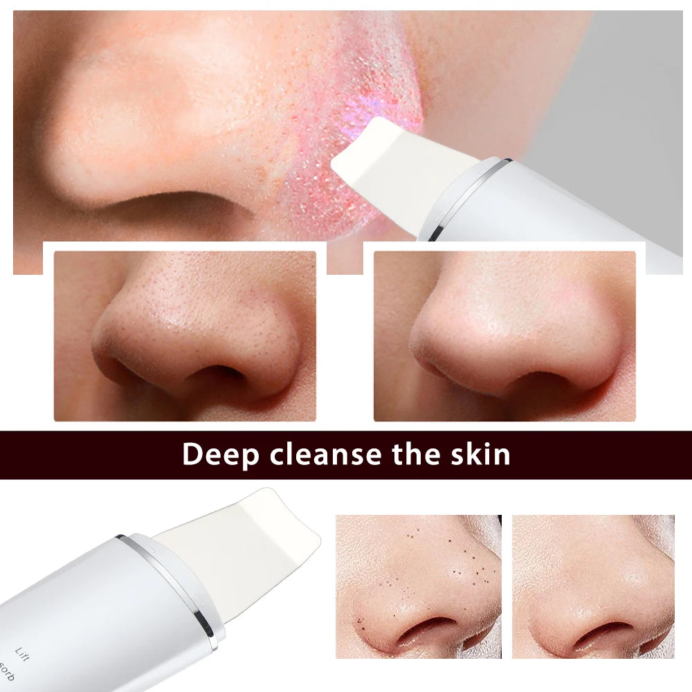 Ultrasonic Facial Skin Scrubber for Deep Pore Cleaning - 23
