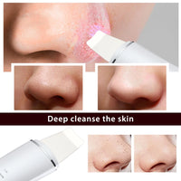 Ultrasonic Facial Skin Scrubber for Deep Pore Cleaning