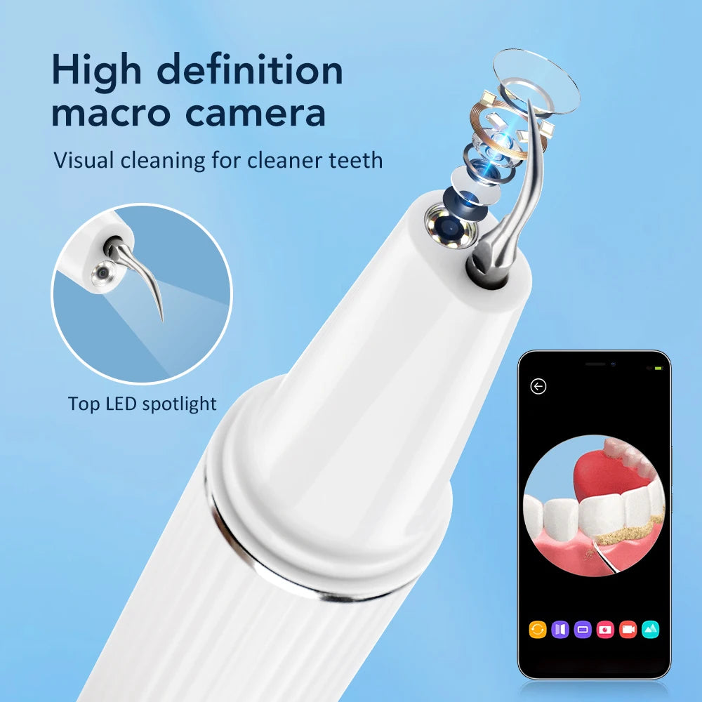 Visual Ultrasonic Tooth Plaque and Tartar Remover - 10