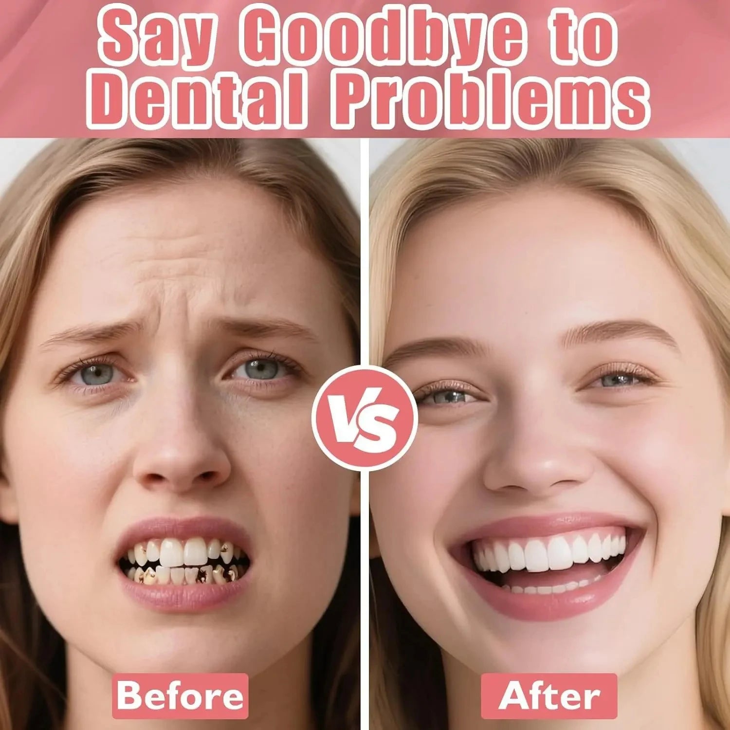 Realistic Temporary Denture Set for a Confident Smile - 4