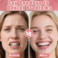 Realistic Temporary Denture Set for a Confident Smile