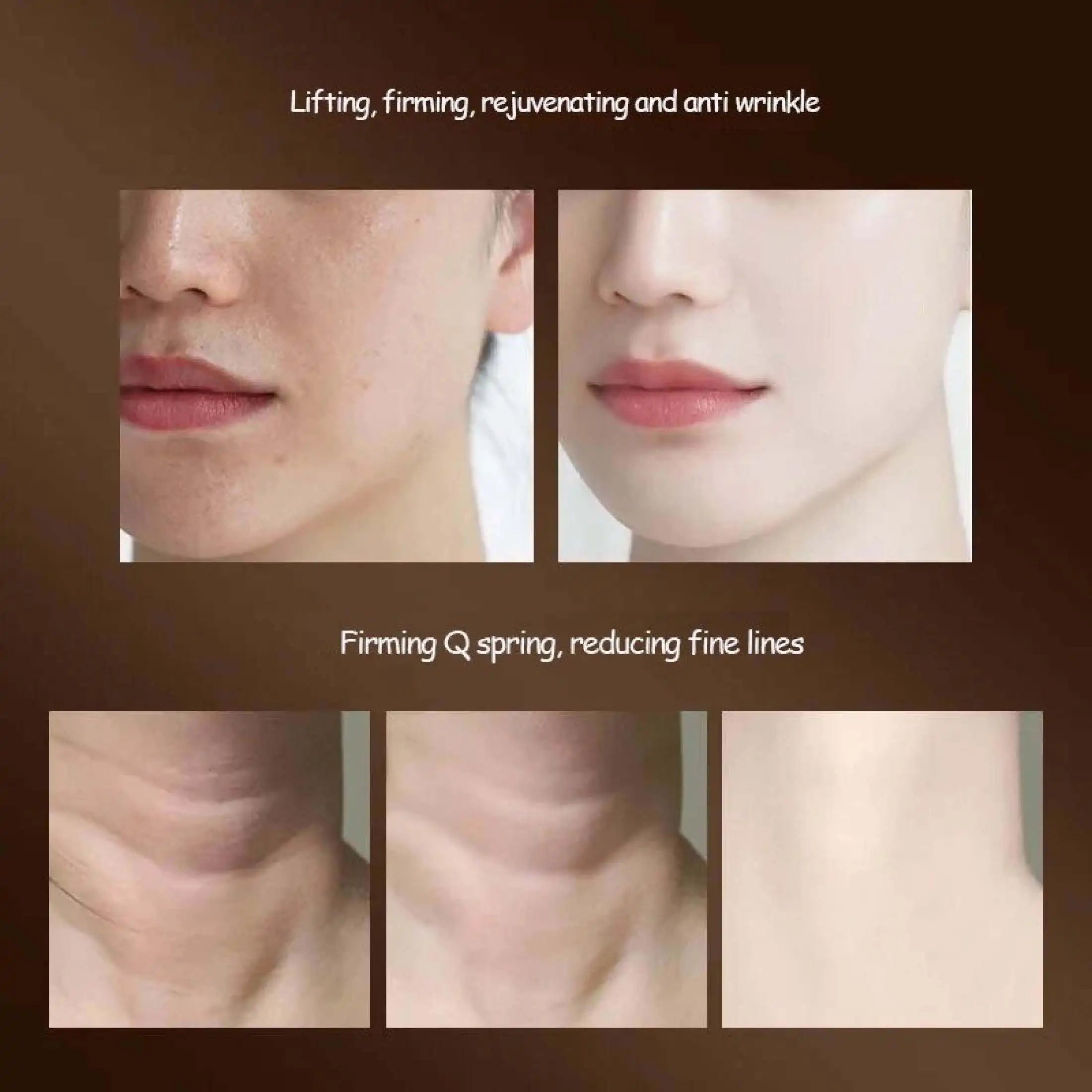Electric Sonic Face and Neck Lifting Massager - 12