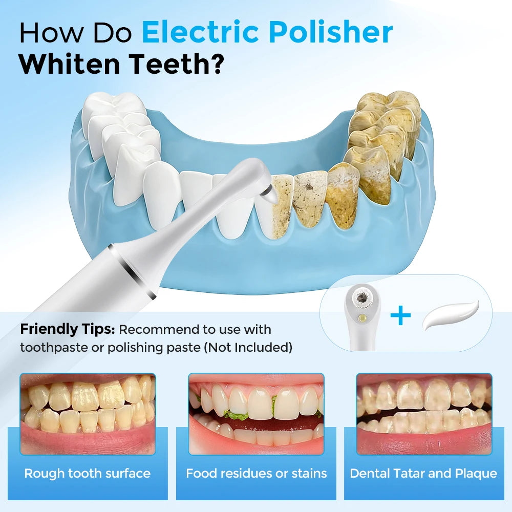 Electric Rechargeable Teeth Polishing and Whitening Kit - 7