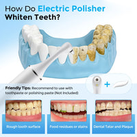 Electric Rechargeable Teeth Polishing and Whitening Kit