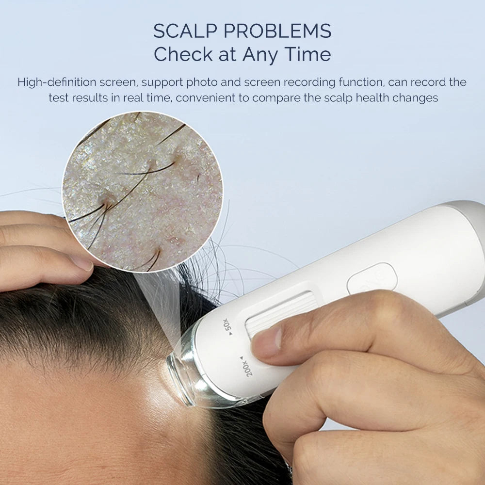 Portable HD Hair Follicle and Scalp Health Analyzer - 6