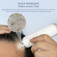 Portable HD Hair Follicle and Scalp Health Analyzer