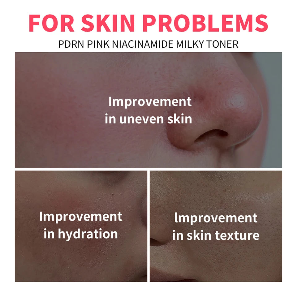 PDRN Niacinamide Milky Toner for Radiant Hydrated Skin - 8