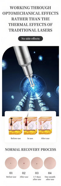 Professional Picosecond Laser Tattoo and Skin Rejuvenation Machine