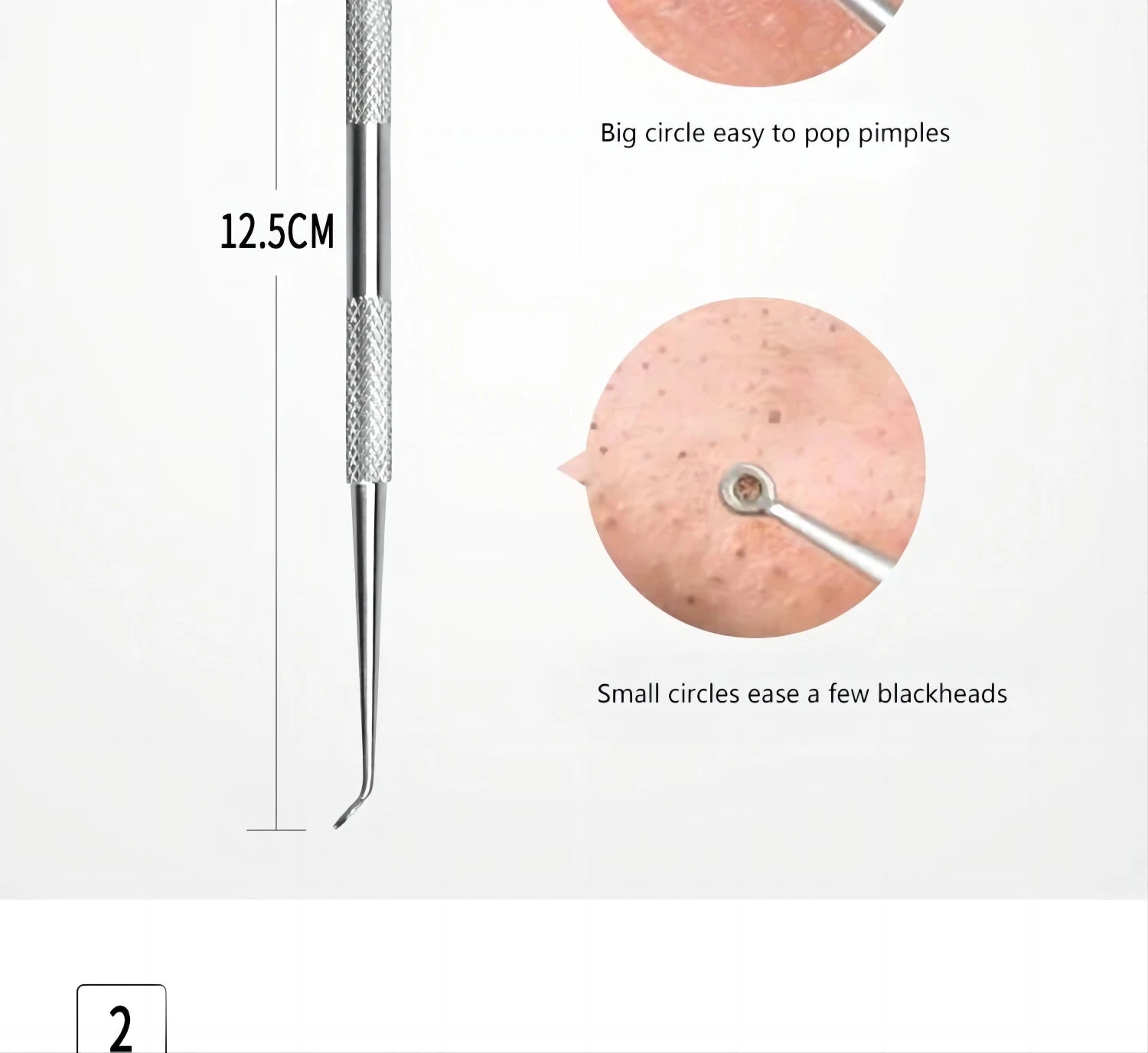 5-Piece Stainless Steel Blackhead and Acne Removal Kit - 12