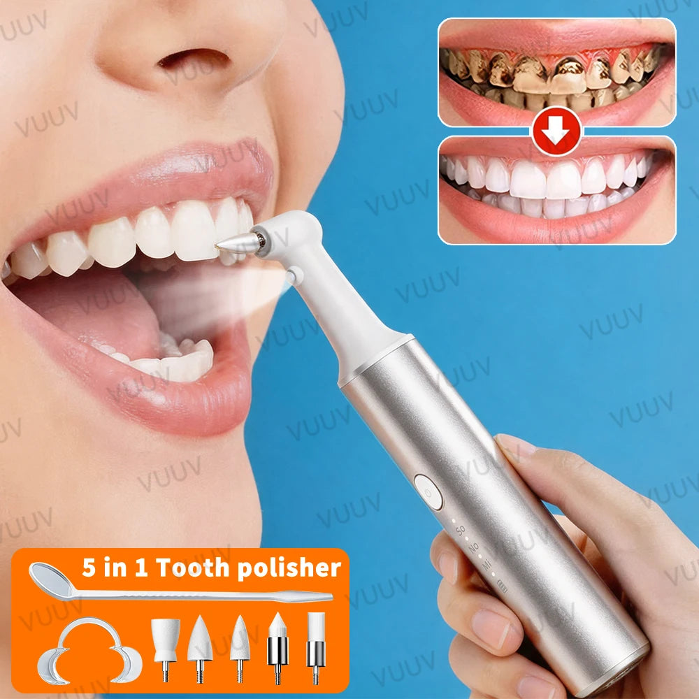 Electric Teeth Polishing and Stain Removal Kit - 1