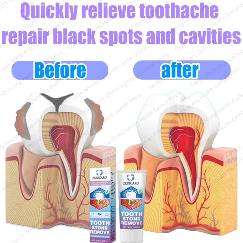 Advanced Dental Repair and Cavity Removal Treatment - 4