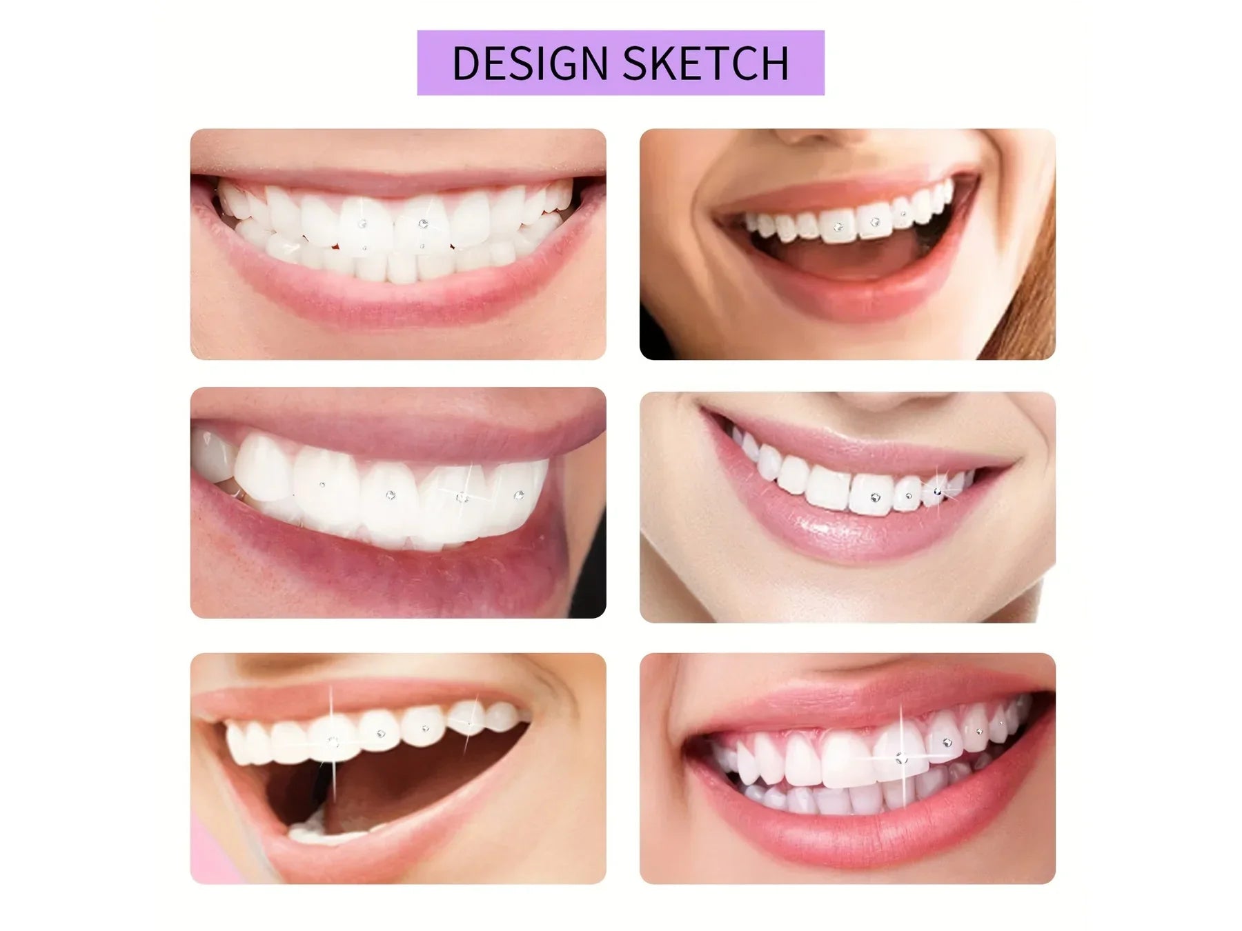 DIY Tooth Gem Kit for Professional Smile Bling at Home - 4