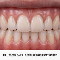 Instant Smile Temporary Denture & Veneer Kit