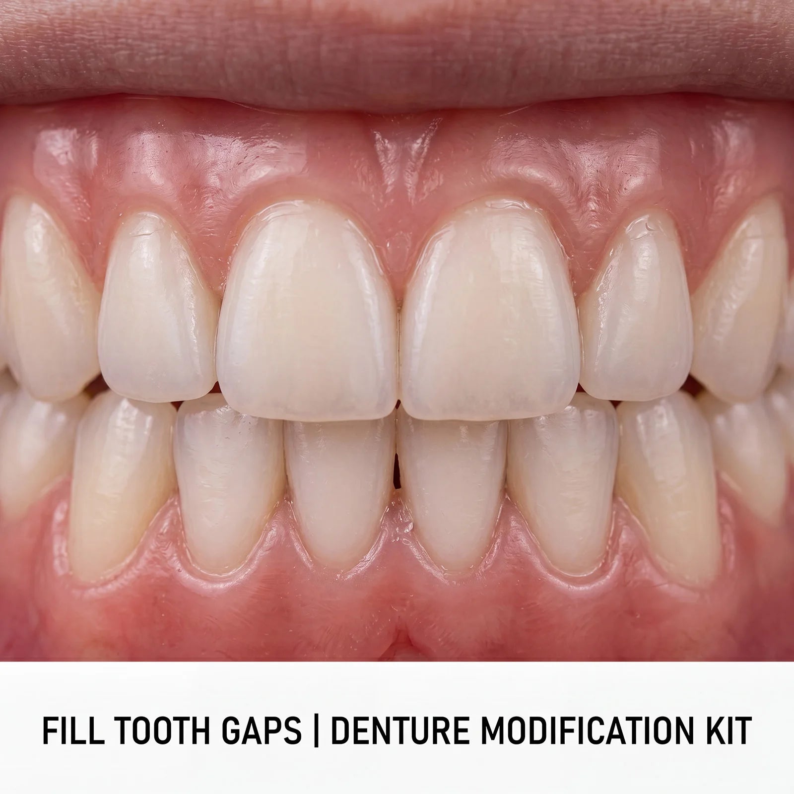 Instant Smile Temporary Denture & Veneer Kit - 10