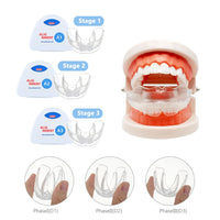3-Stage Kids Orthodontic Teeth Alignment Trainer Set